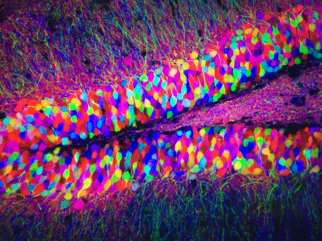 Brainbow J. Lichtman