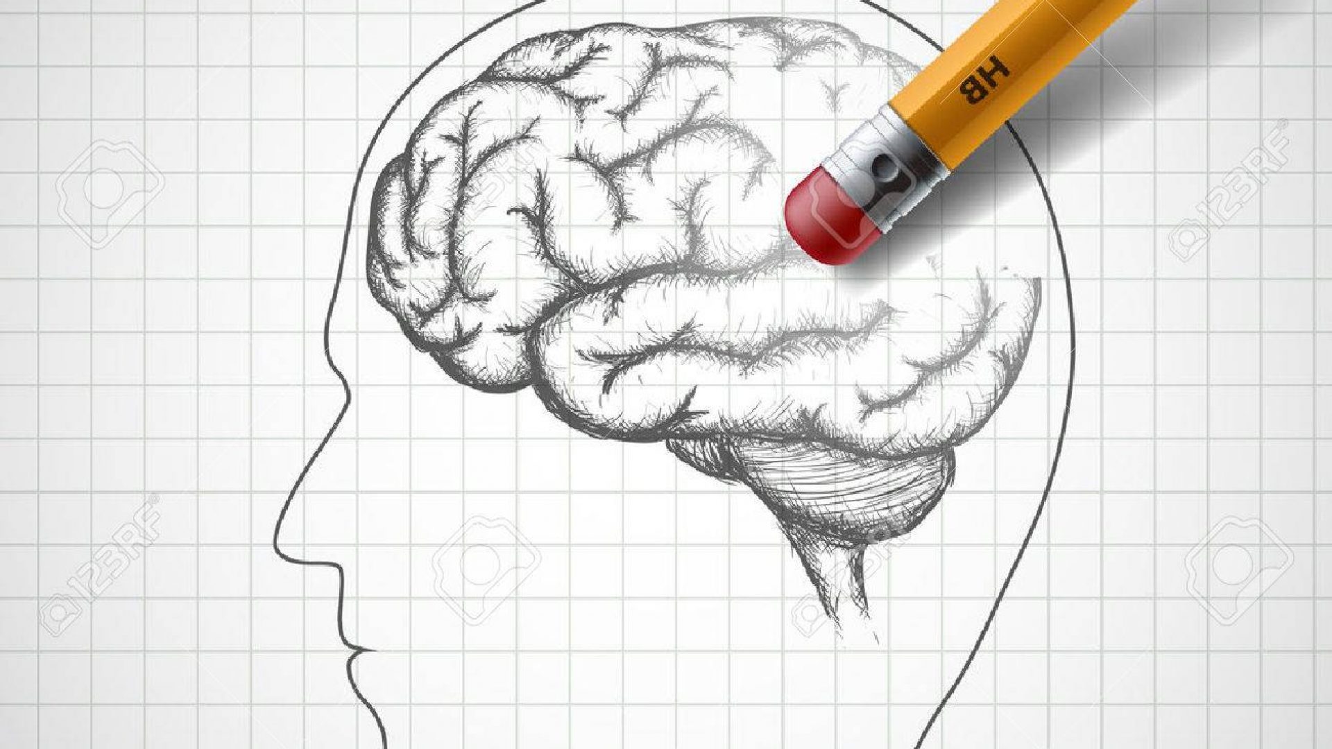 59913915-bleistift-löscht-das-menschliche-gehirn-alzheimer-stock-illustration- 59913915-bleistift-löscht-das-menschliche-gehirn-alzheimer-stock-illustration-